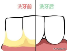 [健康知识普及行动] 口腔预防保健篇之如何让您的牙齿更健康更美白